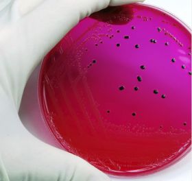 Salmonella discovered at eight US companies